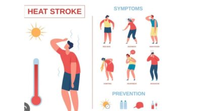 उष्माघात एक आपात्कालीन वैद्यकीय आजार ; लक्षणे, उपचार आणि काळजी..
