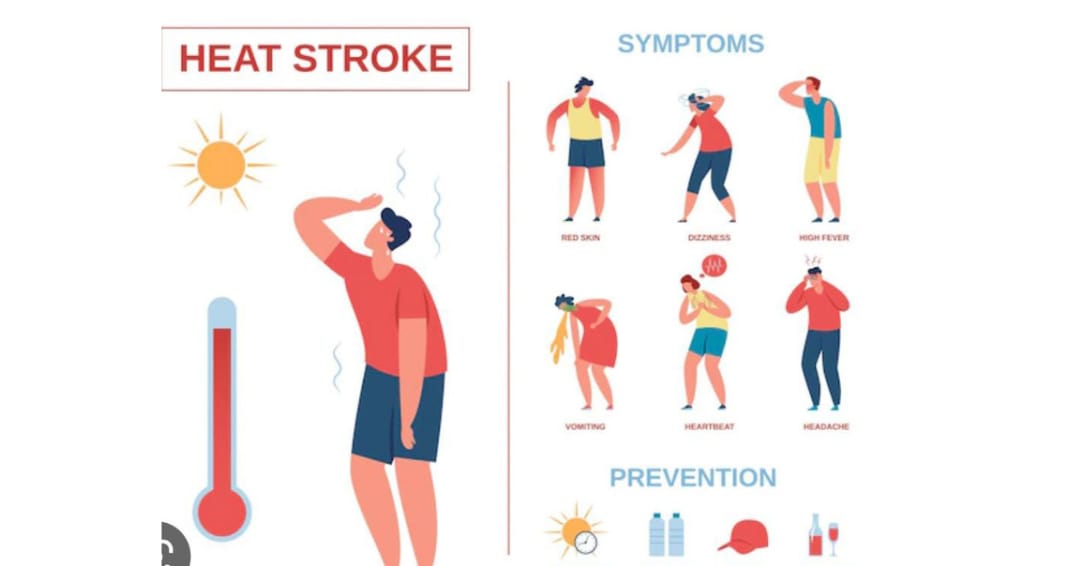 उष्माघात एक आपात्कालीन वैद्यकीय आजार ; लक्षणे, उपचार आणि काळजी..