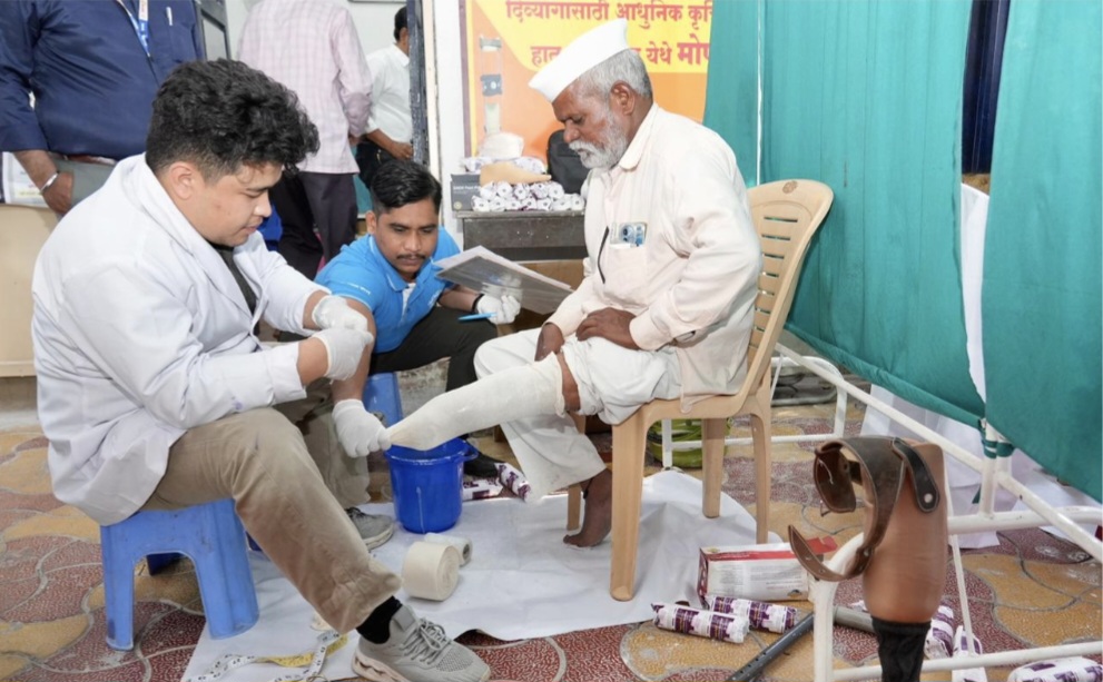 पुण्यातील दिव्यांग बांधवांना मिळणार कृत्रिम अवयव ; मंत्री चंद्रकांत पाटील यांचा विशेष पुढाकार